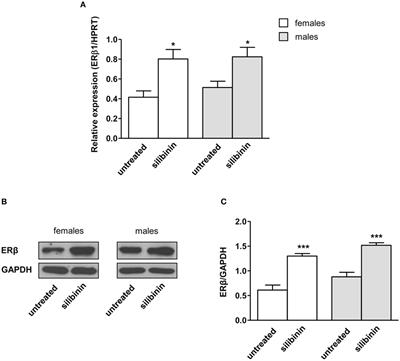 The Natural Agonist of Estrogen Receptor β Silibinin Plays an Immunosuppressive Role Representing a Potential Therapeutic Tool in Rheumatoid Arthritis